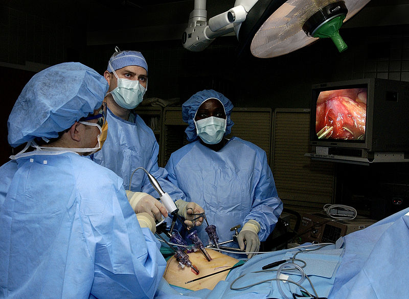 800px Laparoscopic stomach surgery